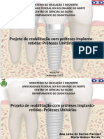 Implantes Unitários