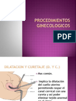 Dilatación y curetaje del cuello uterino