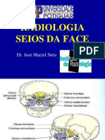 11 - Radiologia Dos Seios Da Face