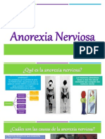 Anorexia Nerviosa