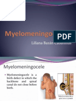 Myelomeningocele