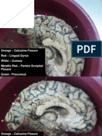 Orange - Calcarine Fissure Red - Lingual Gyrus White - Cuneus Metallic Red - Parieto Occipital Fissure Green - Precuneus