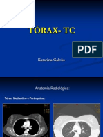 TÓRAX-+ho