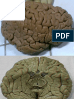 Imagenes Reaqles Del Cerebro