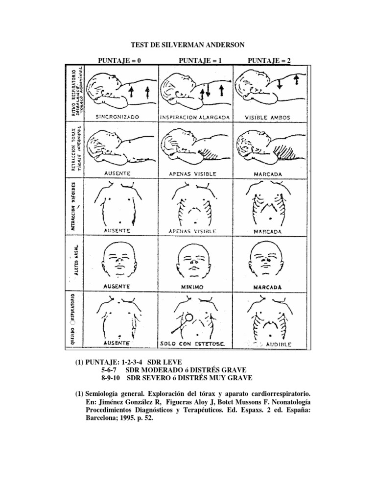 Test de Silverman PDF