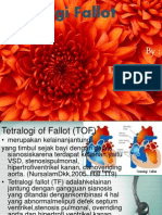 Tetralogi Fallot.pptx
