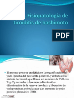 3 Hashimoto Fisiopatologia