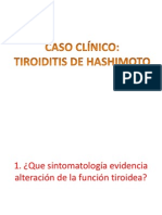 Caso Clinico - Tiroiditis de Hashimoto