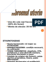 Endometrioza - Fibromul Uterin
