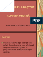 Ruptura uterina