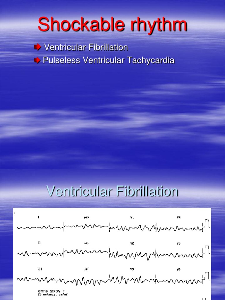 Shockable vs Non-Shockable Rhythms | PDF