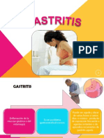 Gastritis Exponer