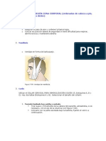 Inmovilizaciones Según Zona Corporal