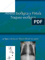 Atresia Esofágica y Fístula Traqueo esofágica