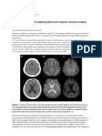 Cerebral Air Emboli On T2 Weighted Gradient Echo Magnetic Resonance Imaging