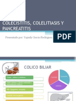 Colecistitis, Colelitiasis y Pancreatitis