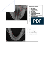 Anatomia Radiografica Oclusal