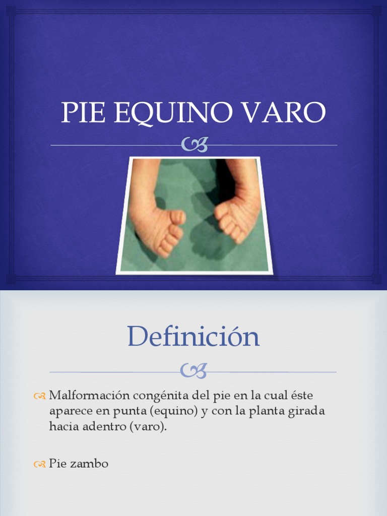 Pie Equino Varo Pie Anatomía humana