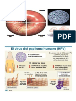 Infección genital por VPH