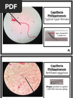 Parasitology (Laboratory) - NEMATODES - Capillaria Philippinensis