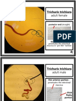 Parasitology (Laboratory) - Trichuris Trichiura