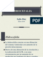 hidrocefalia