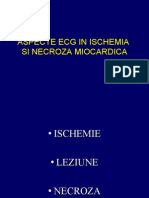 Aspecte ECG in Ischemia Si Necroza Miocardica
