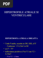 ECG Hipertrofii