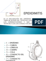 EPIDIDIMITIS