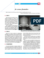 Agenesia de Senos Frontales
