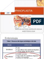 TIMPANOPLASTIA