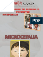 Microcefalia Final