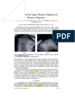 Separation of The Upper Humeral Epiphysis in Pituitary Gigantism