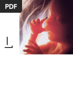 Download Abortion  by jeanpesky SN16240019 doc pdf