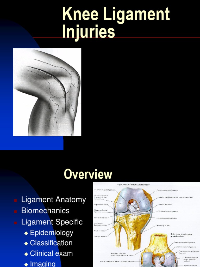 Knee Ligament Injuries Soft Tissue Knee