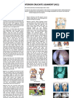 Cedera Anterior Cruciate Ligament