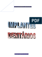 Implantes Dentários (Manual).pdf