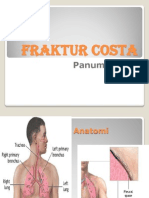 Fraktur Costa