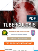 Tbc Anciano