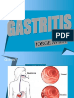 Gastritis