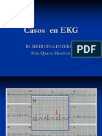 CASOS EKG