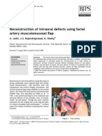 Reconstruction of Intraoral Defects Using Facial Artery Musculomucosal Flap