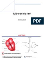 Tulburari de Ritm