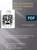 Chest X Ray Techniques and Positioning