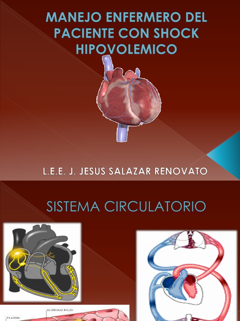 Manejo Enfermero Del Paciente Con Shock Hipovolemico | PDF | Choque ...