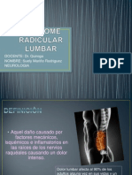 Sindrome Radicular Lumbar