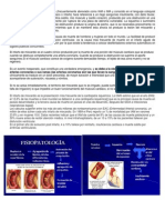 El término infarto agudo de miocardio