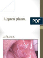 Liquen Plano