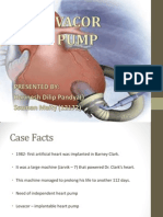 Levacor Heart Pump Presentation