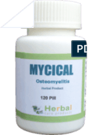 Mycical For Osteomyelitis Treatment